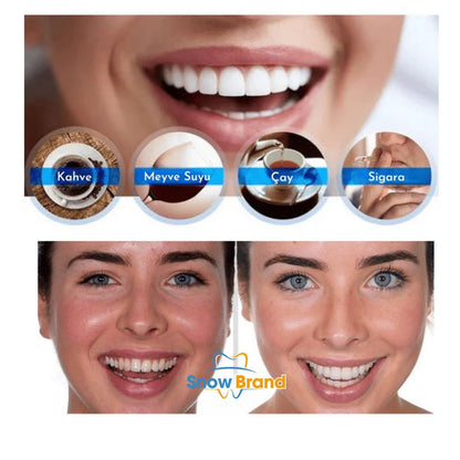 Ekstra Güçlü Diş Beyazlatma Kalemi